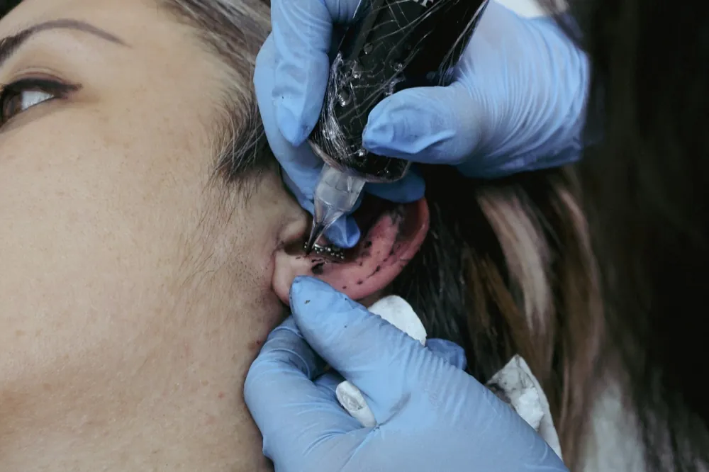 Detalle en la piel